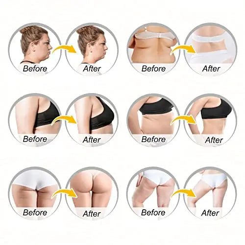 2PCS VOGSIG Ginger Slimming Cream - Anti Cellulite, Fat Burning, Tightening & Moisturizin - TrustMedUSA
