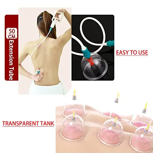 MYMM 12 Cupping Cups Sets Biomagnetic Traditional Professional Chinese Therapy Massage MYMM Au supplements