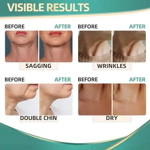 Neck Cream for Tightening Firming: Instant Face Lift Cream - Wrinkle Cream for Women RONKIE Au supplements