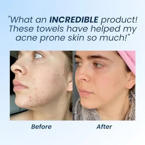 Clean Skin Club Clean Towels XL, Dermatologist Approved, 100% USDA CLEAN SKIN CLUB Au supplements
