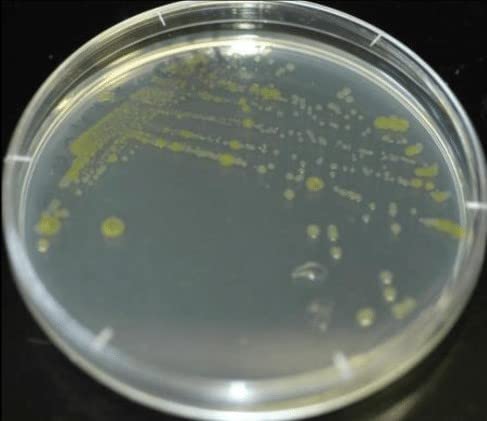 Diamante Scientific Essential Bacteria Kit. Pre-Poured Agar Plates & Swabs. Perfect for Kids. Great for Learning About Microbiology. STEM Education. Experiment Guide eBook Included! Diamante Scientific Au supplements