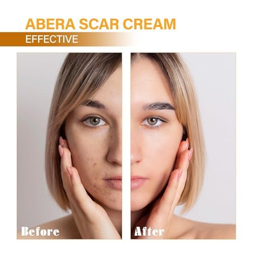 ABERA Scar Removal Cream for Women and Men - Rapid Repair of New Old Scars, Spots, Burns All Natural Treatment with Vitamin E, Alanine, Collagen (1 Box + 3 Eye Patch) ABERA Au supplements