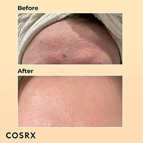 COSRX Snail Mucin 96% Power Repairing Essence 3.38 fl.oz 100ml COSRX Au supplements