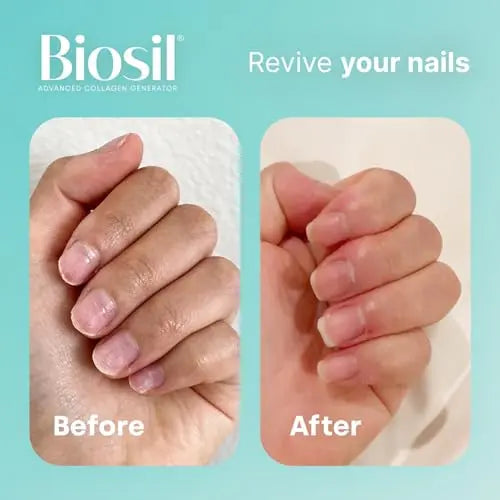 Biosil Collagen Generator - 60 Capsules - with Patented ch-OSA Complex - Generates & Protects Your Own Collagen BioSil Au supplements