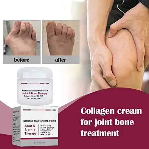 Joint Collagen Relieves Joint Soreness And Body Joint Care Collagen Get Thick Products Generic Au supplements