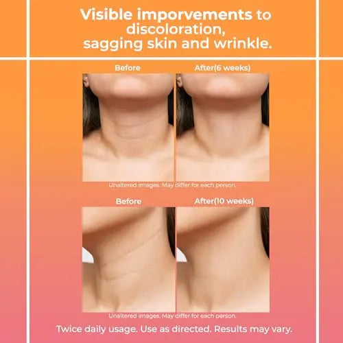 Neck Firming Cream for Women: Neck Cream - Neck Tightening Cream - Neck Creams Lemcuh Au supplements