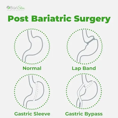 BariSlim Bariatric Calcium Citrate with Magnesium and Vitamin D Tabs - 500 mg of Calcium BariSlim Au supplements