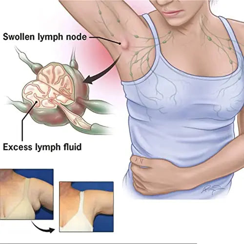 CSIYANJRY99 Lymph Purifying Ring Lymphatic Drainage Therapeutic Rings Set CSIYANJRY99 Au supplements