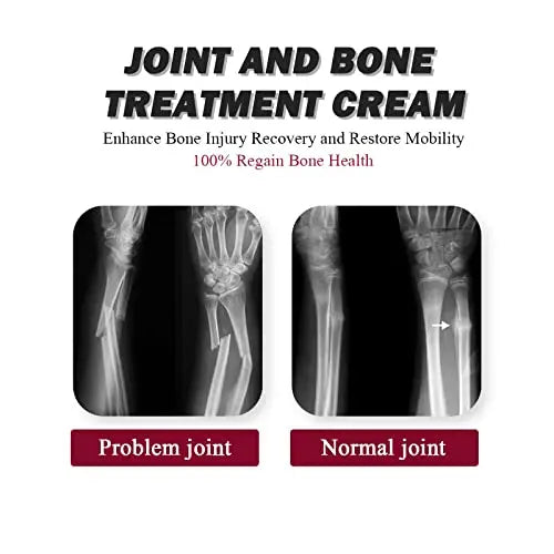 Joint Collagen Relieves Joint Soreness And Body Joint Care Collagen Get Thick Products Generic Au supplements