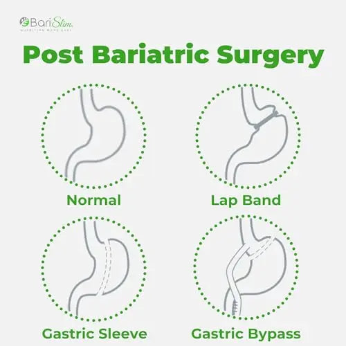 BariSlim Iron Plus Capsules - Formulated for Patients After Weight Loss Surgery Including BariSlim Au supplements