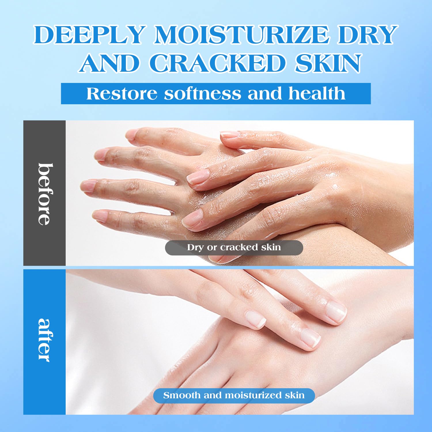 42% Urea Cream for Dry & Cracked Skin - Foot & Hand Cream with 2% Salicylic Acid, 5% Vitamin E, Tea Tree Oil, Aloe Vera, Shea Butter - Moisturizer & Skin Repair Cream for Feet Maximum Strength - Maple Wellness Supplements