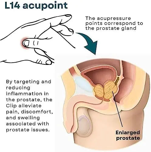XEYOW Prostate Care Point Clip for Men, Acupressure Hand Pressure Point Clip, Relieve Prostate XEYOW Au supplements