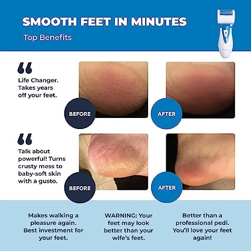 Electric Callus Remover: Own Harmony Professional Pedicure Tools Foot Own Harmony Au supplements