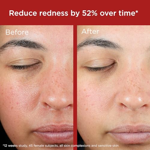 EltaMD UV Skin Recovery Green Tint 100% Mineral Sunscreen, SPF 50, Redness Correcting