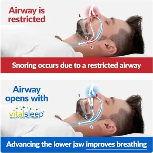 VitalSleep Anti-Snoring Mouthpiece, Adjustable Jaw Positioning Vital Sleep Au supplements