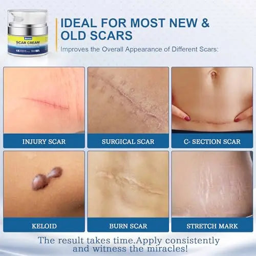 BORMSI Scar Cream,Active Silicone Dimethicone Scar Gel-Advanced BORMSI Au supplements