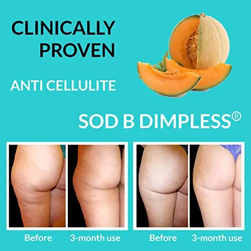 UpNourish Anti Cellulite Supplements - Varicose Veins Support, Restless Leg Relief UpNourish Au supplements