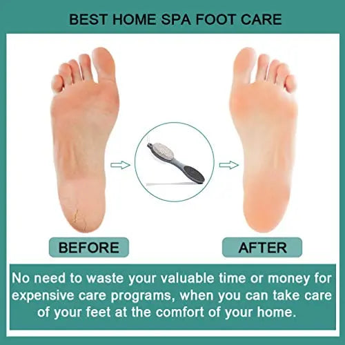CAREHOOD Foot File Callus Remover - Multi Purpose 4 in 1 Feet Pedicure CAREHOOD Au supplements