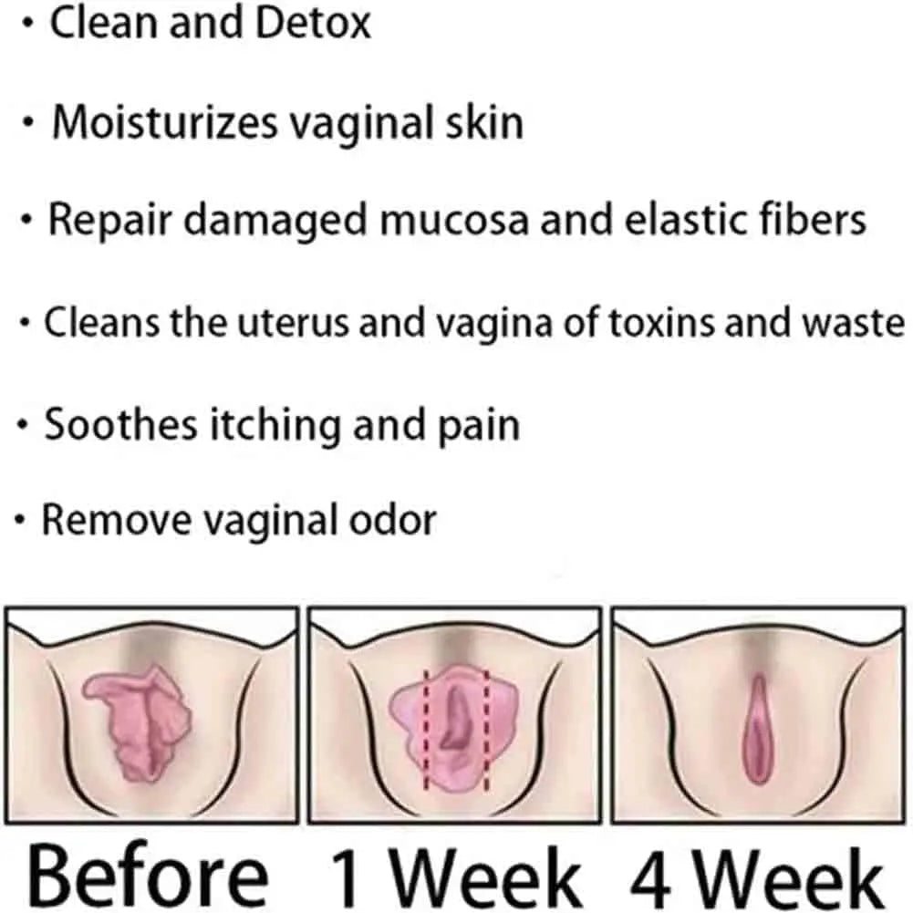Natural Repair Vagianal Capsules, Anniecare Instant Anti-Itch Detox Slimming Products GDSAFS Au supplements