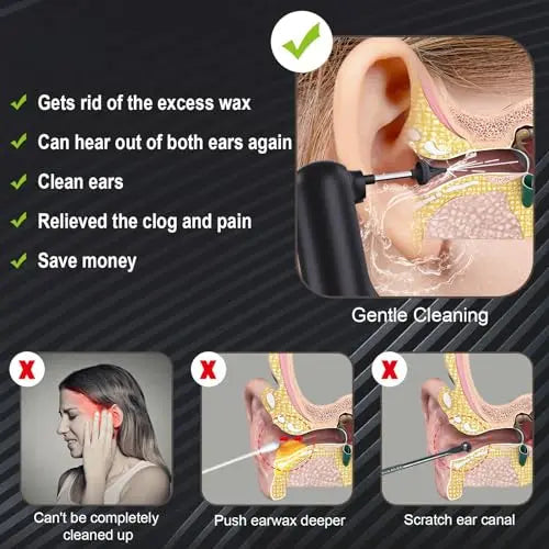 Upgraded Ear Wax Removal,Water Powered Ear Cleaner,Ear Cleaning Kit Alledge Au supplements