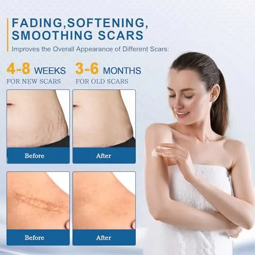 BORMSI Scar Cream,Active Silicone Dimethicone Scar Gel-Advanced BORMSI Au supplements