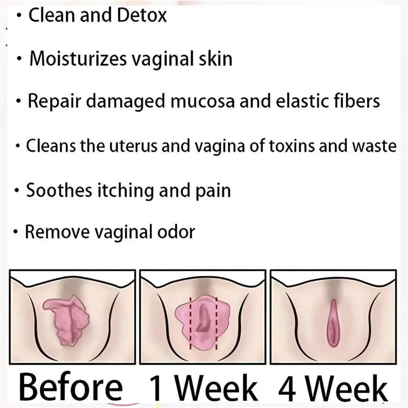 tsoneoo Dexcara Detox Repair - Natural Repair Vagianal Capsules, Natural Repair Vajinal Capsules tsoneoo Au supplements