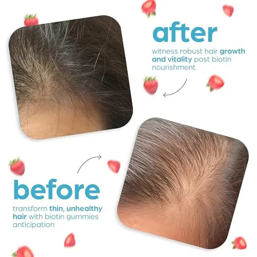 Artnaturals Biotin Gummies for Hair Growth - (100 Gummies - 10000mcg) - Natural Strawberry Artnaturals Au supplements