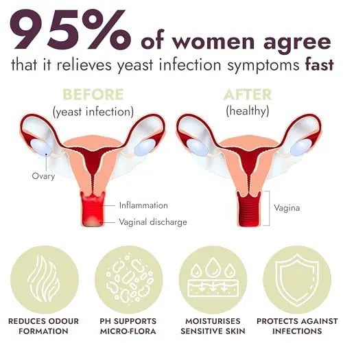 Yeast Infection Treatment for Women | 7 Pre-Filled Applicators w/ Borax | Antifungal Ointment Terramed Just Think Comfort Au supplements