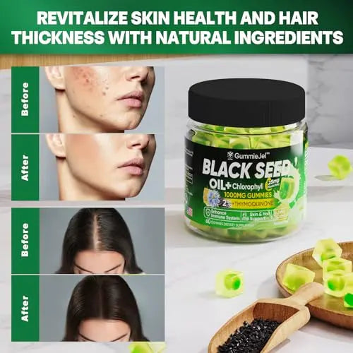 Sugar Free Black Seed Oil Filled Gummies & Chlorophyll, with Hydrolyzed Collagen EnvyCure Au supplements
