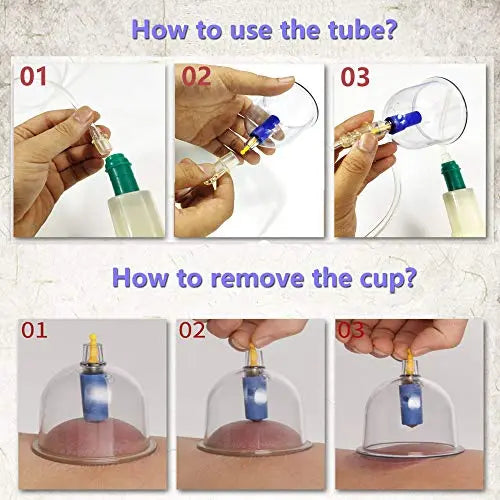 MYMM 12 Cupping Cups Sets Biomagnetic Traditional Professional Chinese Therapy Massage MYMM Au supplements