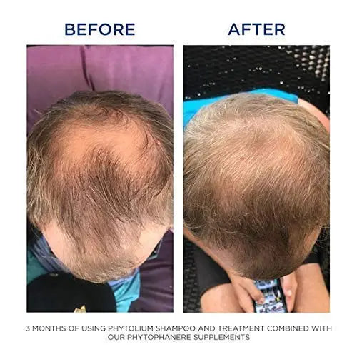 PHYTO Phytophanère 100% Natural Hair Loss Thinning Dietary Supplement PHYTO Au supplements