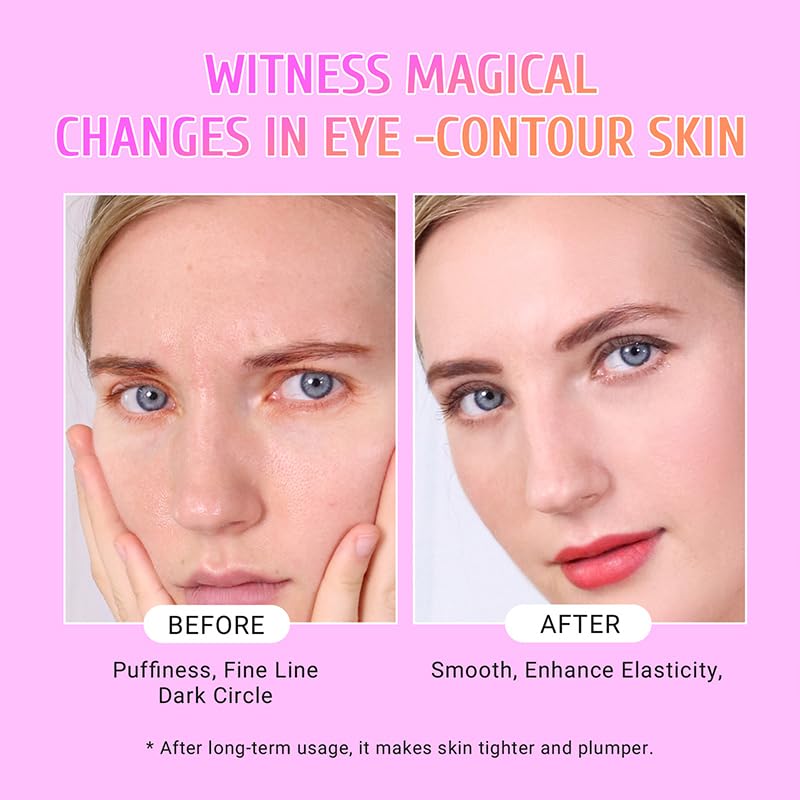 PEAUAMIE Under Eye Patches Gold and Hyaluronic Acid for puffy eyes,Rose Eye Masks
