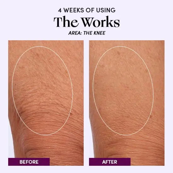 Womaness Summer Travel Skin Bundle - The Works Mini Size - Menopause Womaness Au supplements