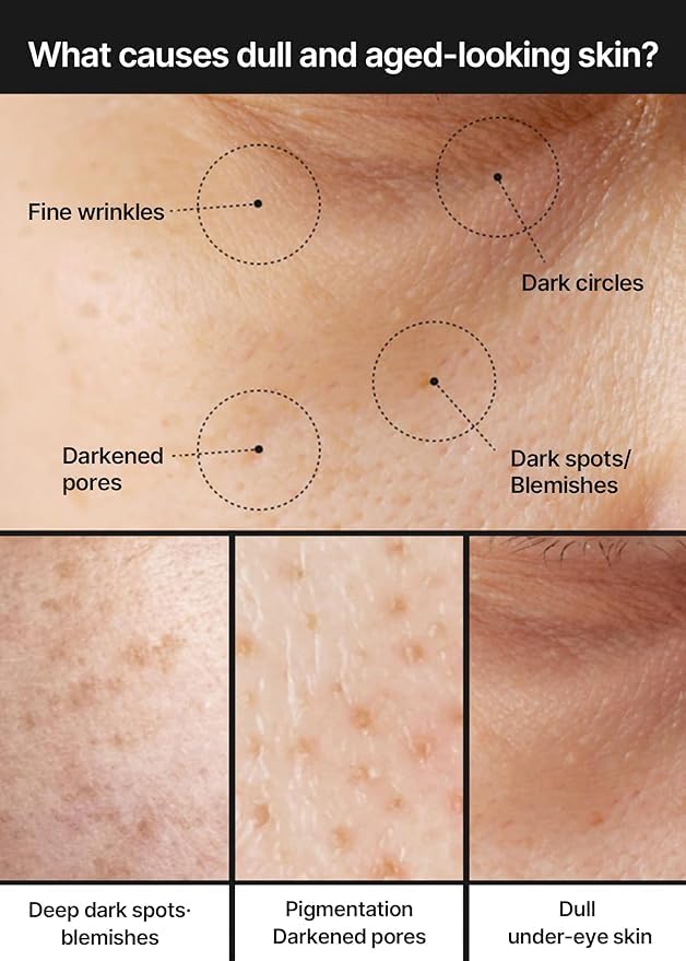 celimax Pore+Dark Spot Brightening Cream | with Niacinamide, Tranexamic Acid, TXA Cream