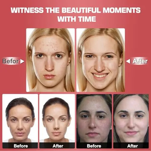 Red Light Therapy M-Ask Red Light Facial M-Ask Red Light Therapy for Face 7-1 Colors Light for Face Home Use LORICK Au supplements