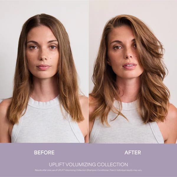 VEGAMOUR UPLIFT and Refresh Kit | Volumizing Dry Shampoo Spray Formulated Without Benzene, Supports Thicker Fuller Looking Hair | $50 Value VEGAMOUR Au supplements