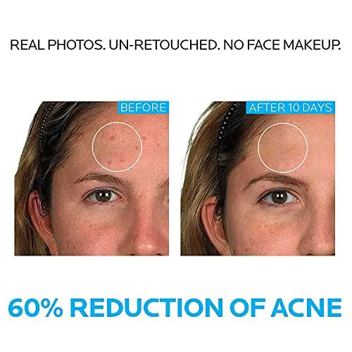 La Roche-Posay Effaclar Dermatological 3 Step Acne Treatment System La Roche-Posay Au supplements