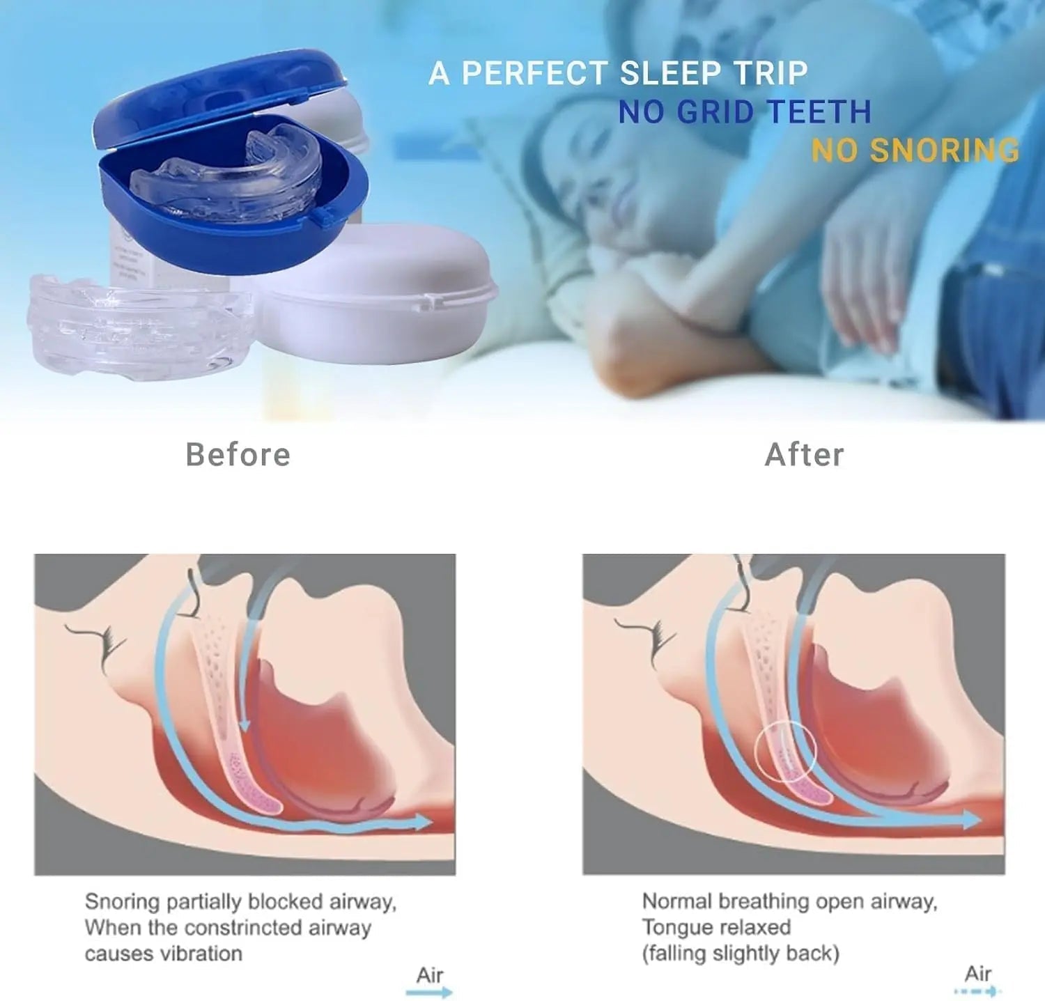 SereneSleep Mouthpiece (Blue) BAWOTY Au supplements