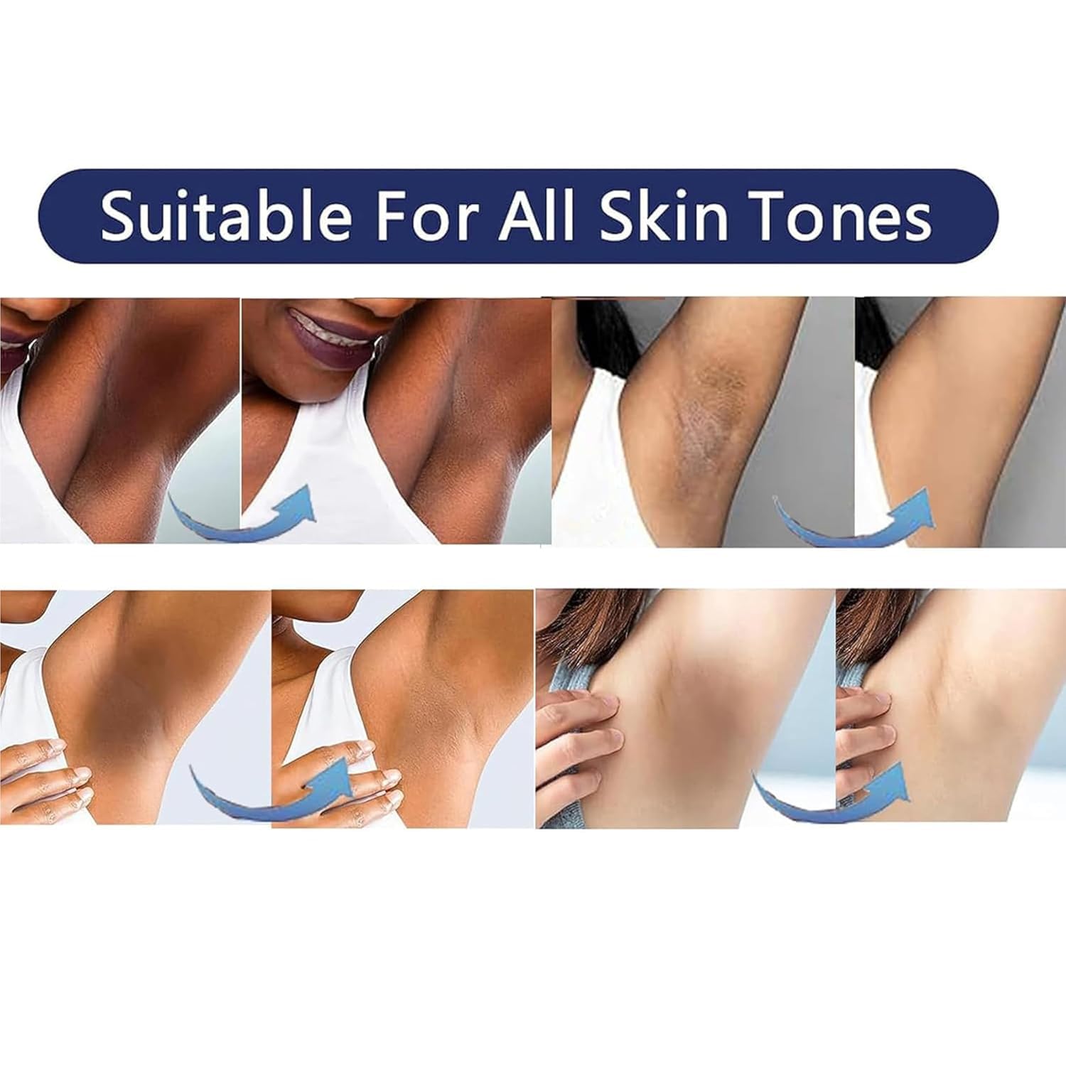 Vcetree Skin Bleaching Cream Skin Lightening for Body Intimate Areas, Private Parts, Underarm, Knees, Elbows, Inner Thigh, Bikini Area