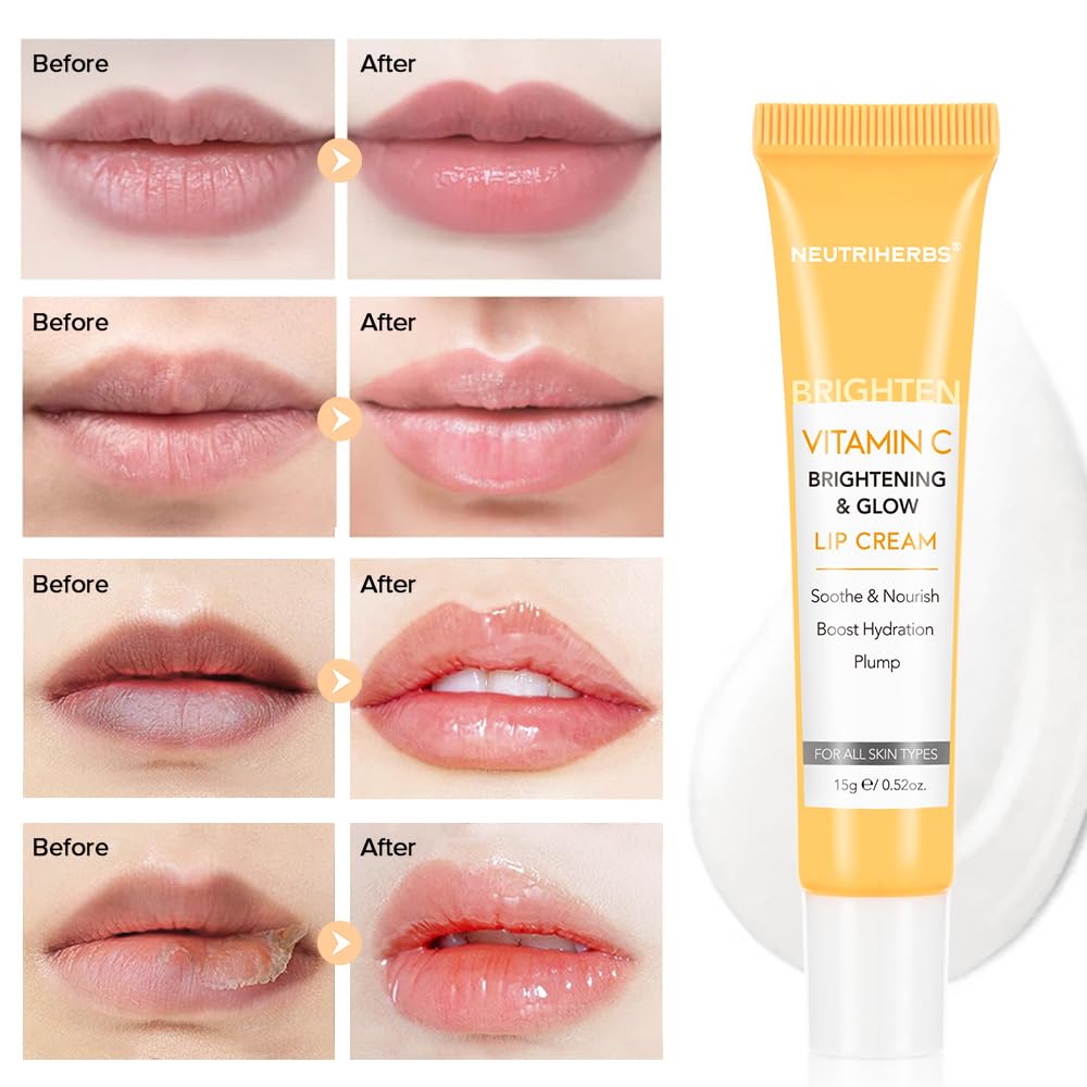 NEUTRIHERBS Lip Cream, Vitamin C Lip Balm to Nourish and Soothes Dry, Cracked Lips