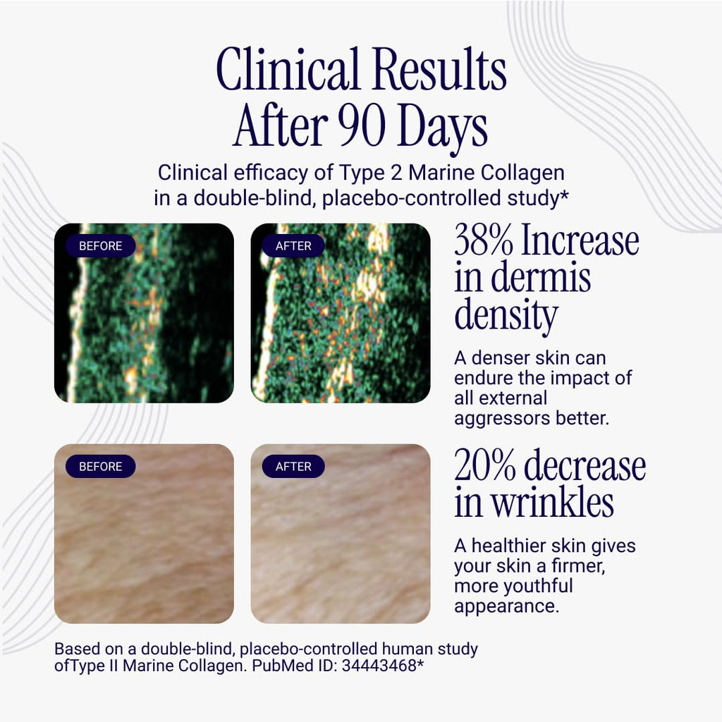Rho Nutrition Liposomal Collagen Peptides - High-Absorption Liquid Collagen Supplement - Supports Skin Elasticity, Joint Health