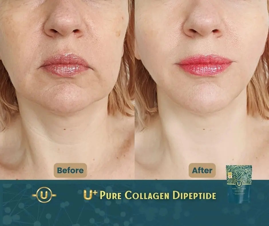 U+ Pure Collagen Dipeptide Supplement - Advanced Hydrolyzed Collagen Powder for Skin, Hair U+ Pure Collagen Au supplements