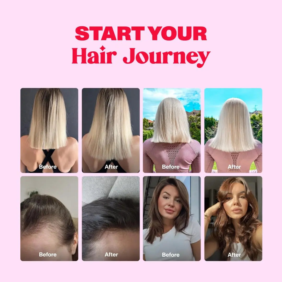 Bloom Robbins 60 Hair Gummies for Faster Hair Growth Vitamins for Women & 5000 MCG Bloom Robbins Au supplements