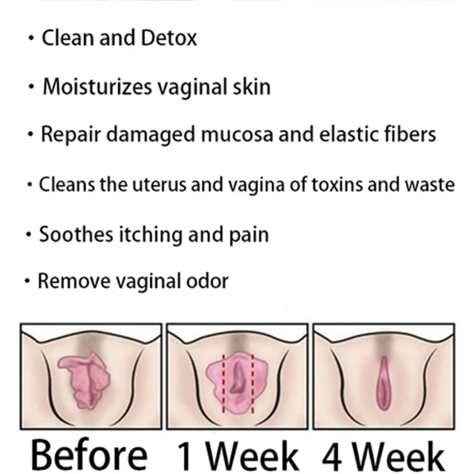 Dexcara Detox Repair - Anti-Itch Detox Slimming, Instant Anti-Itch Detox Products Generic Au supplements