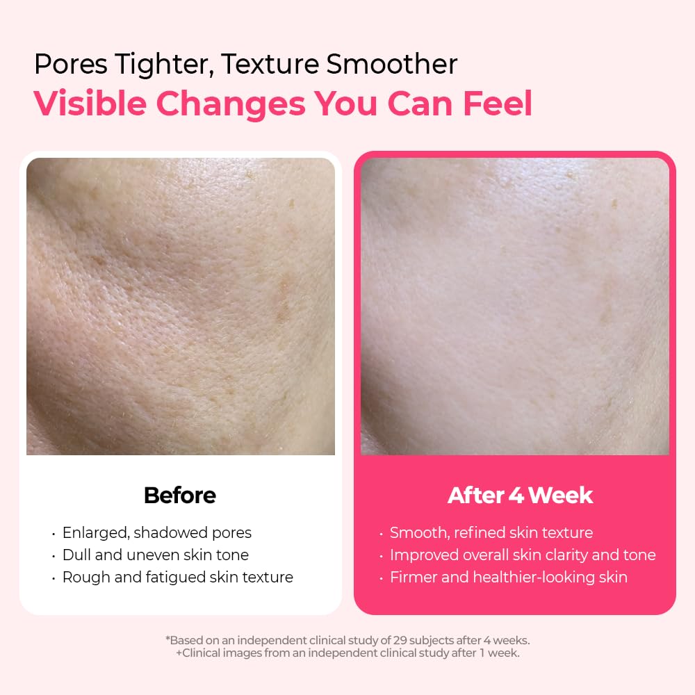 Dr.Melaxin Cyano Pink Spicule Niacinamide Serum – Vitamin B12 Pore Minimizer, Liquid Microneedle Facial Treatment