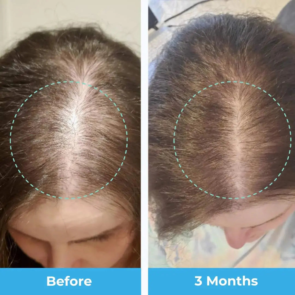 Baby Blues Postpartum Hair Loss Vitamins - Passion Fruit Gummies with Biotin, Collagen, & Folate Baby Blues Au supplements