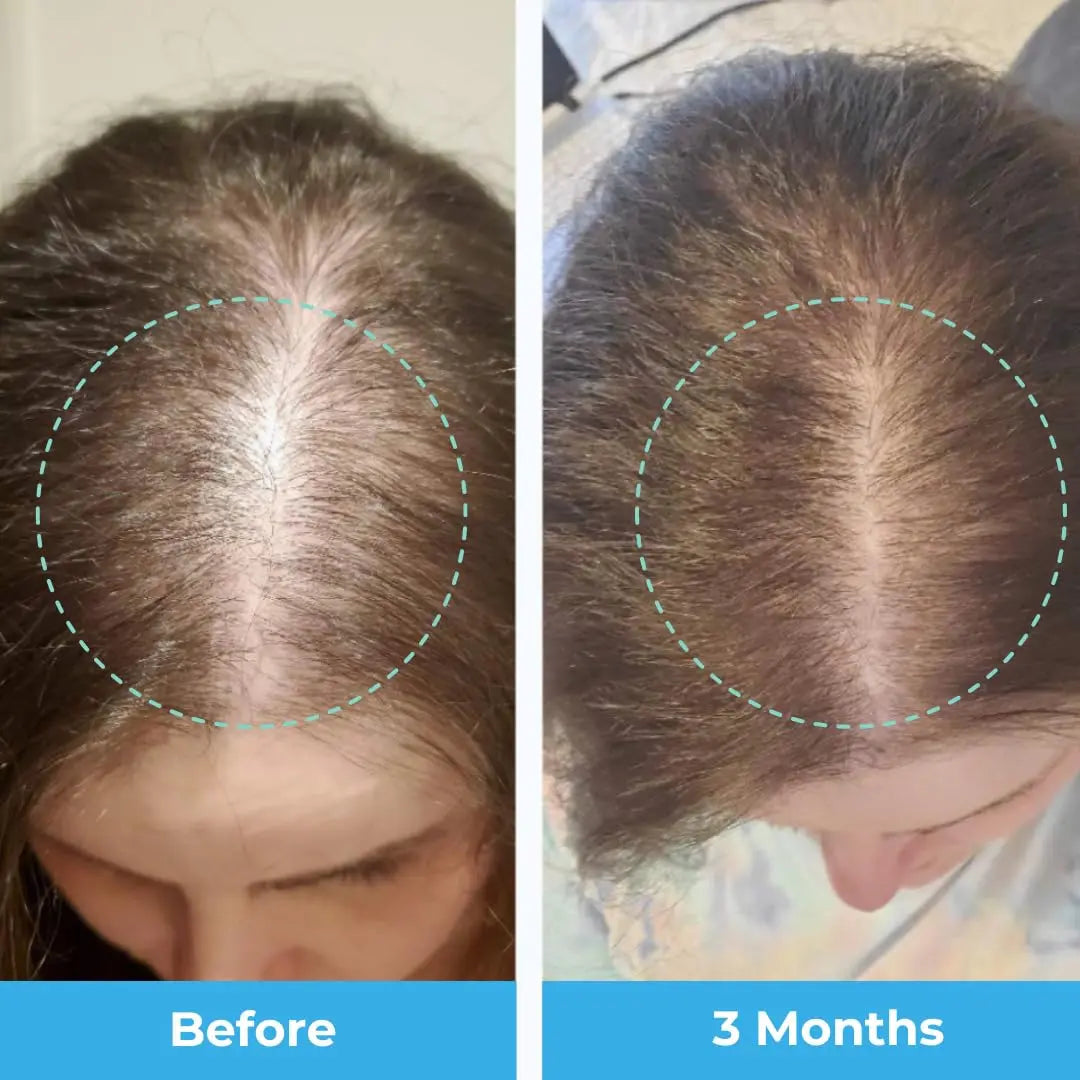 Baby Blues Postpartum Hair Loss Vitamins - Passion Fruit Gummies with Biotin, Collagen, & Folate Baby Blues Au supplements