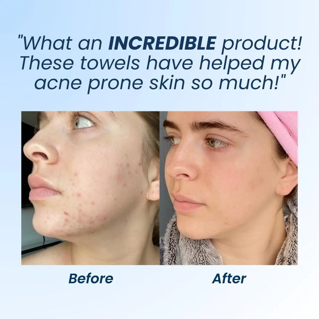 Clean Skin Club Clean Towel XL, 100% USDA Biobased Dermatologist CLEAN SKIN CLUB Au supplements