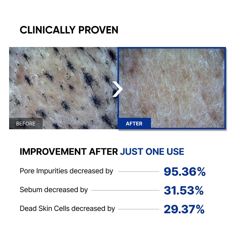 SAYNID MICROBIOME RENEWING CREAM MASK TRIAL KIT, Wash-off Cream, Soft Exfoliating Face Scrub Dead Skin Cells | 4.5g/0.15oz (3EA) SAYNID Au supplements