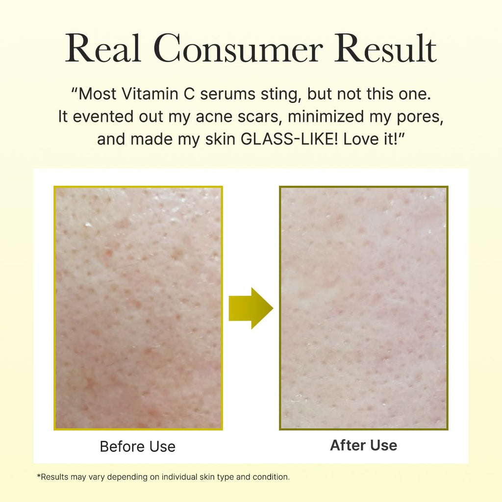 Arencia Vitamin C Booster Shot Serum with Glutathione, Niacinamide and Vitamin E for Dark Spot Care, Fine Lines & Wrinkles